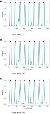 A simple and effective deep neural network based QRS complex detection method on ECG signal